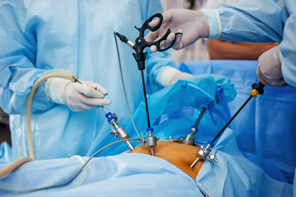 General & Laparoscopic Surgery